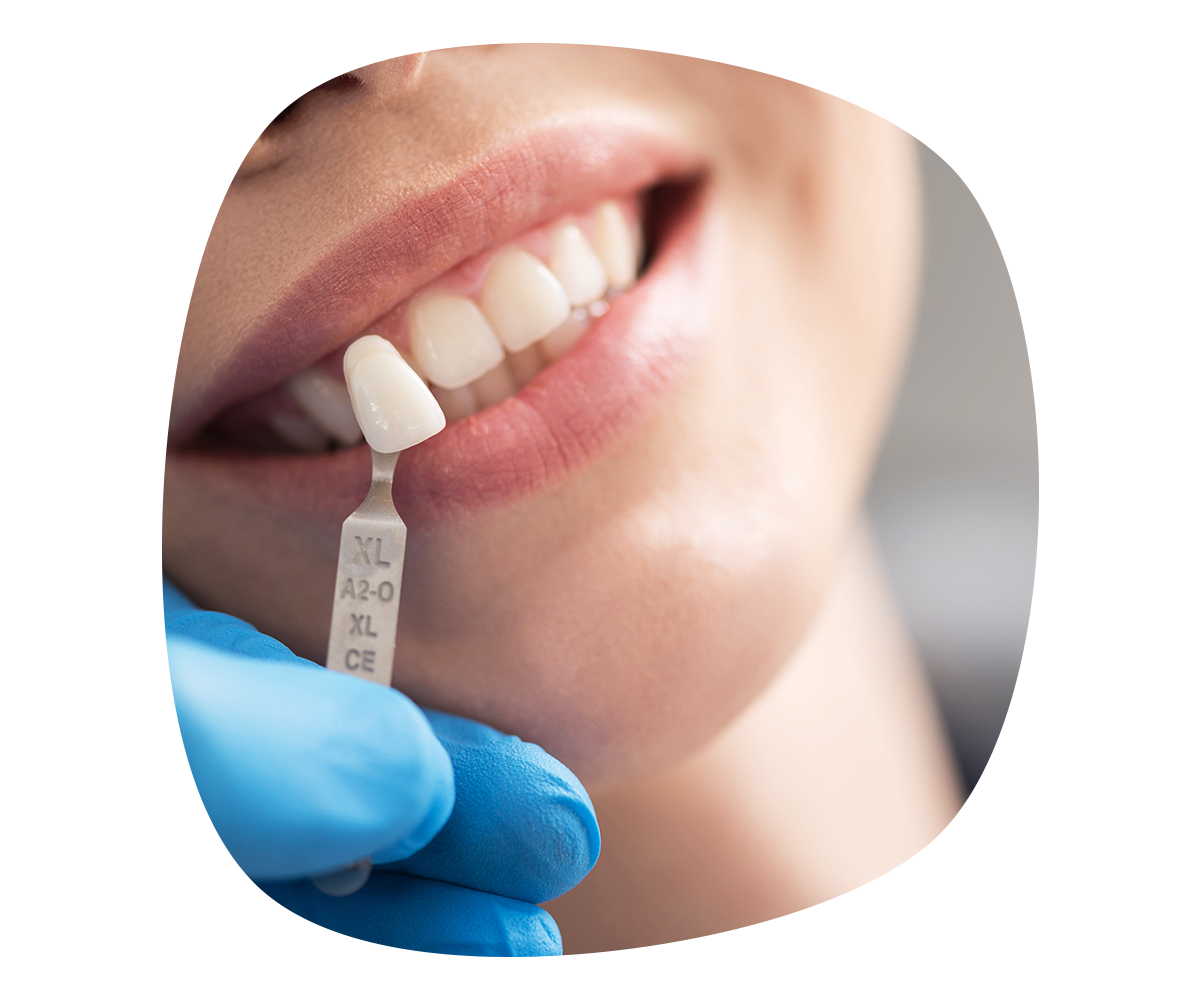 https://www.dentaline-clinic.com/wp-content/uploads/2023/07/s5.png